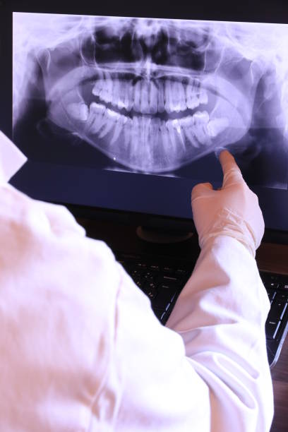 Best Emergency Root Canal Treatment in Independence, OH