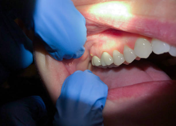 Best Emergency TMJ Treatment in Independence, OH